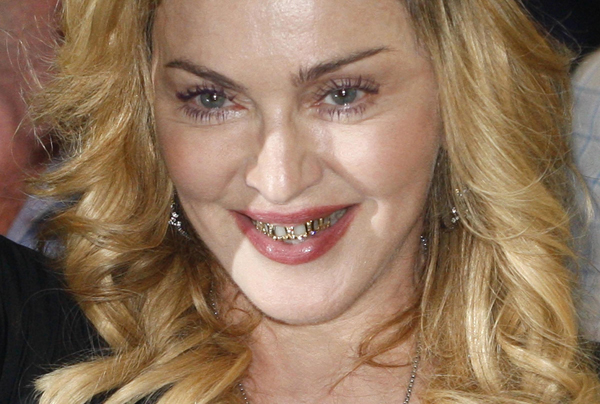 madonna+golden+teeth1