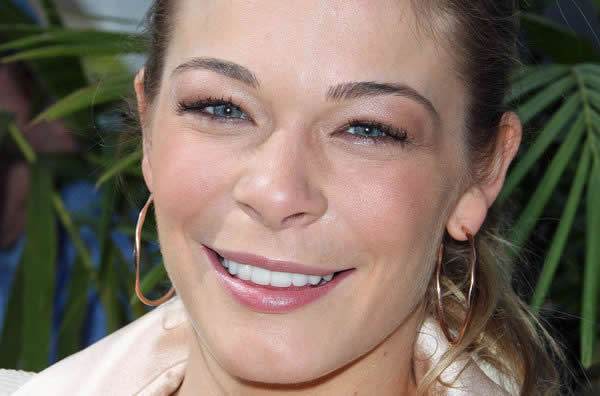 leann-rimes-sues-dentist
