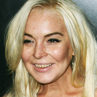 pg-07-Lindsay-Lohan-celebs-bad-teeth-full